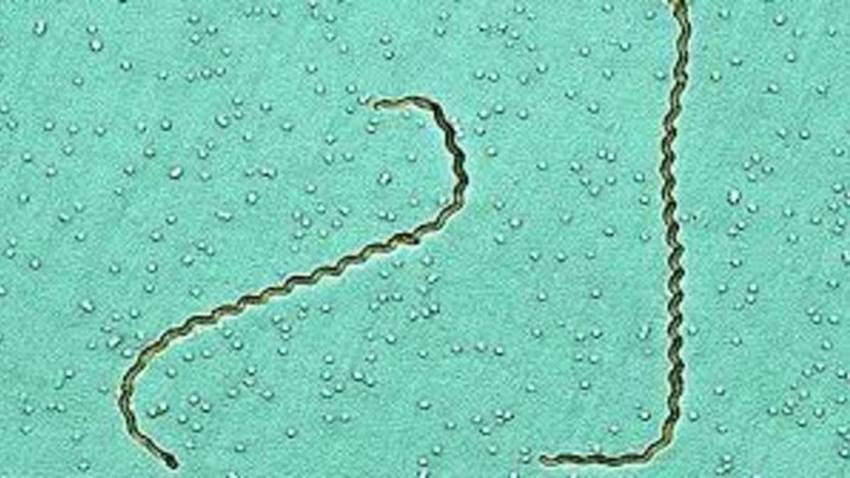 Leptospirosis importada: Rabdomiólisis e hiperbilirrubinemia severa en viajero al ingresar a Puerto Rico