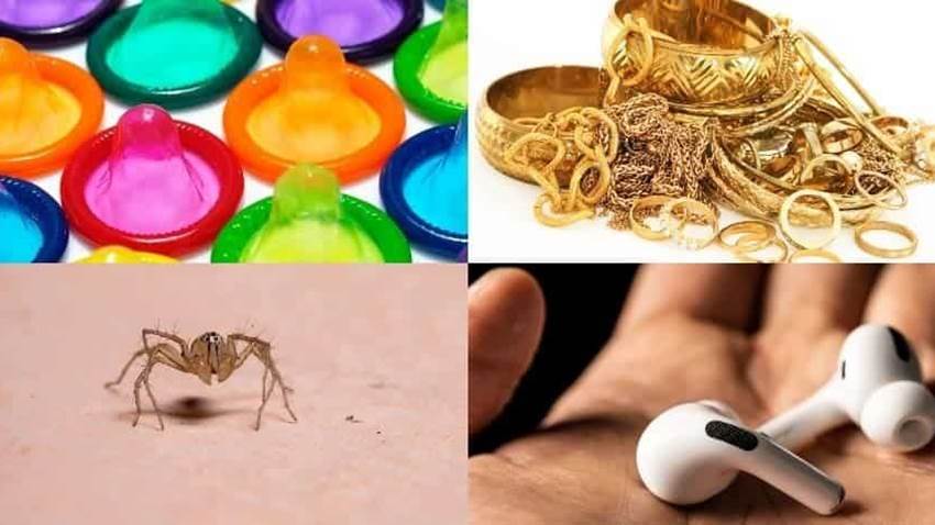 Casos de objetos extraños extraídos del cuerpo de humanos