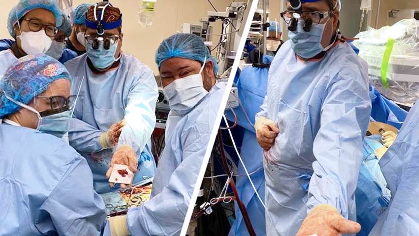 Cirujanos salvan la vida de paciente no apto para cirugía con su propia válvula