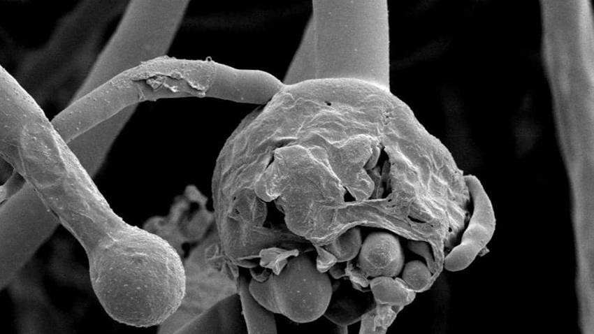 6 preguntas claves para entender el “hongo negro” que ataca a pacientes de Covid-19