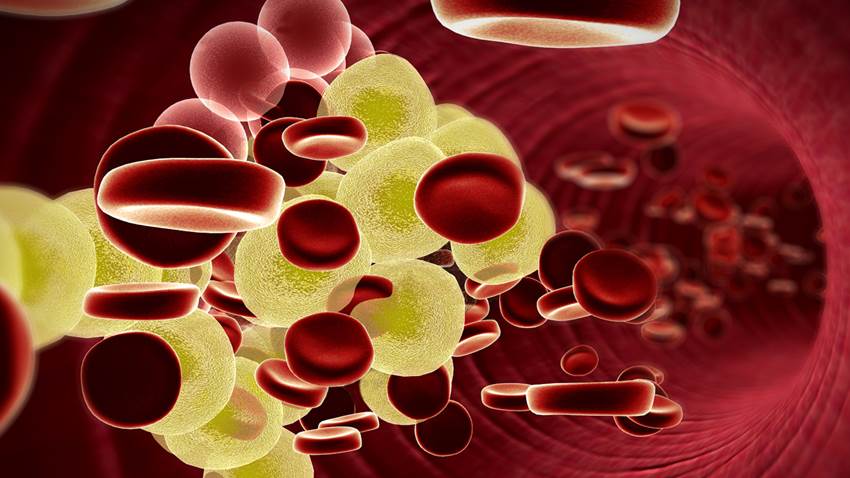 Prevención y tratamiento del colesterol alto (hiperlipidemia)