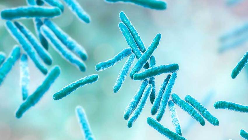 Análisis de sangre predeciría la tuberculosis hasta seis meses antes de los síntomas