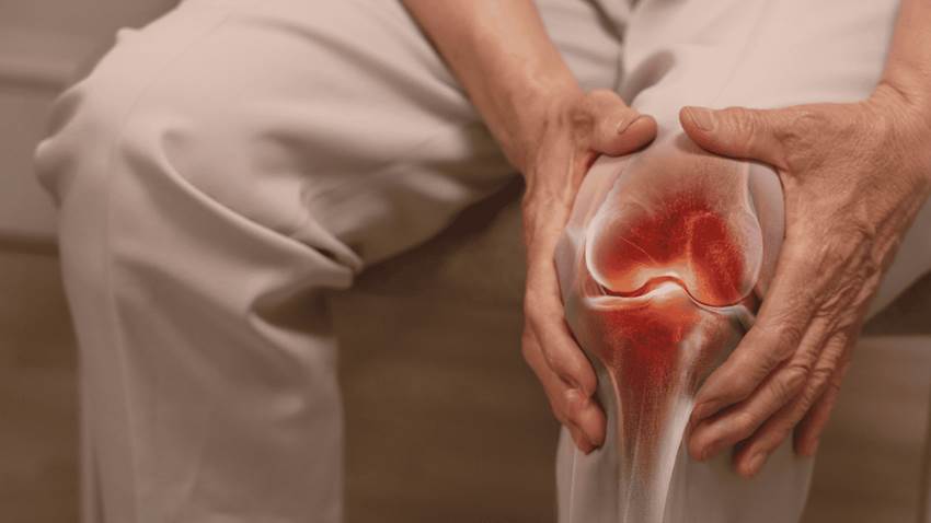 Aumenta los casos de pacientes de artritis reumatoide que no presentan inflamación en las articulaciones