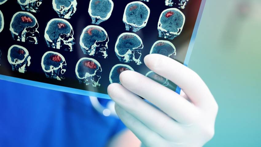 VPH: factor de riesgo en el desarrollo de diversos tipos de cáncer