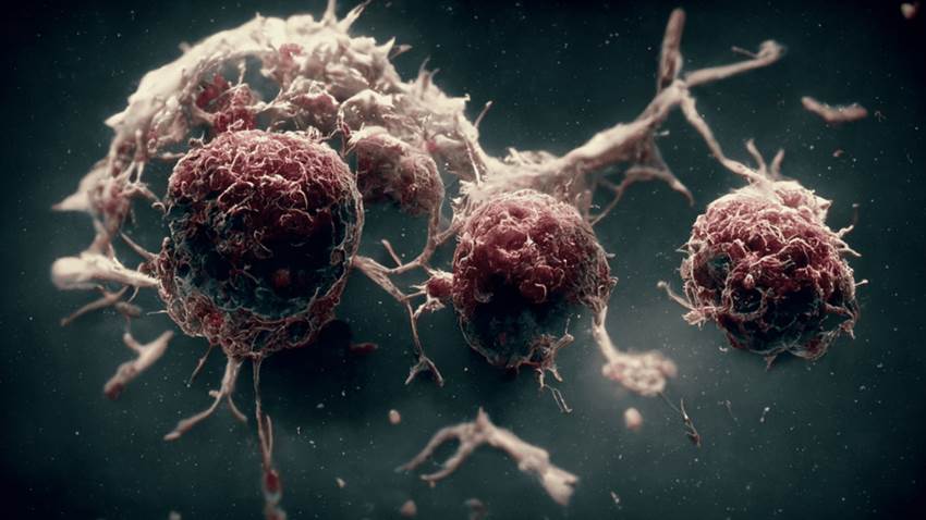 Primera fase exitosa de Omomyc: mini proteína terapéutica que impide el crecimiento tumoral en el cáncer