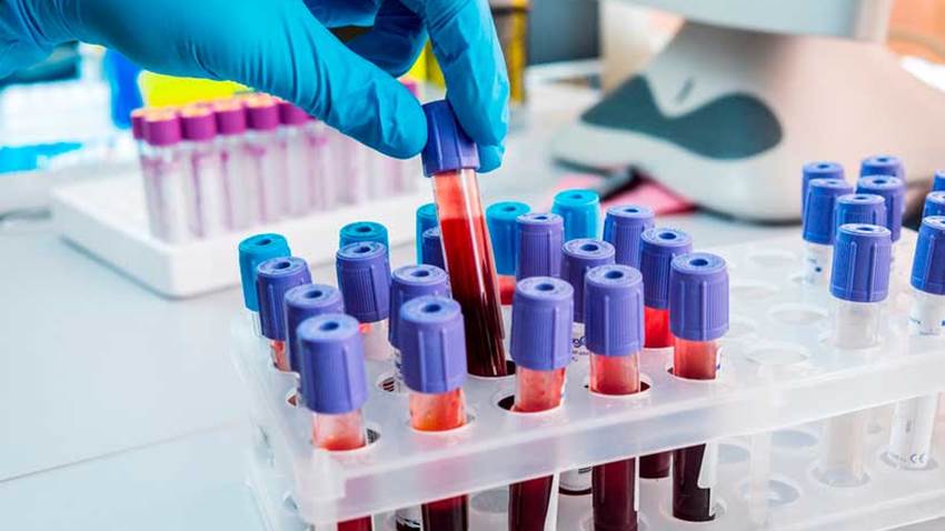 Descubren que molécula de la sangre sería efectiva contra la enfermedad autoinmune del riñón