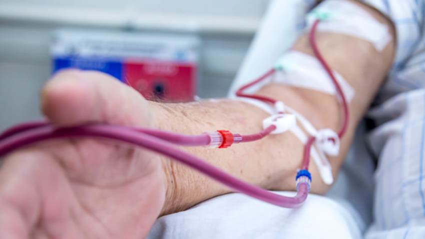 Cómo enfrenta el COVID-19 un paciente en diálisis