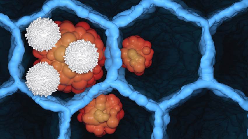 Identifican el mecanismo molecular que promueve el inicio de la metástasis tumoral