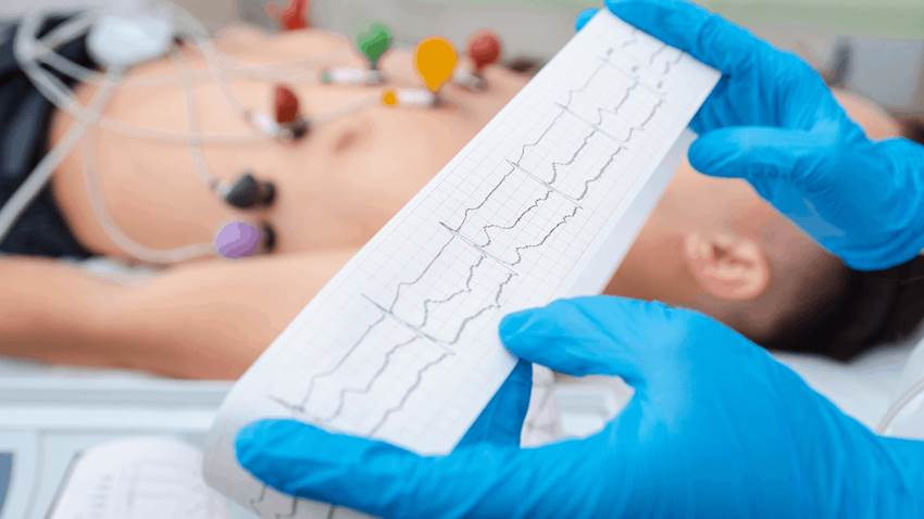 Estudio confirma que no existe relación entre el consumo del café y problemas cardíacos