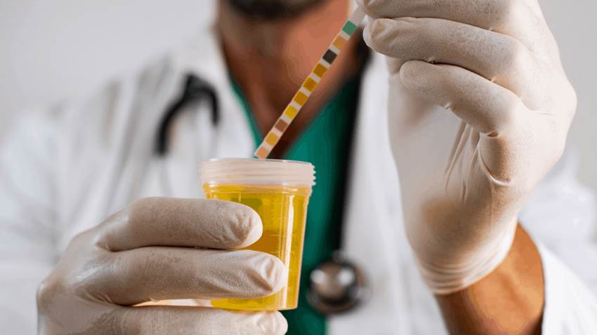 ¿Qué causa la orina turbia?