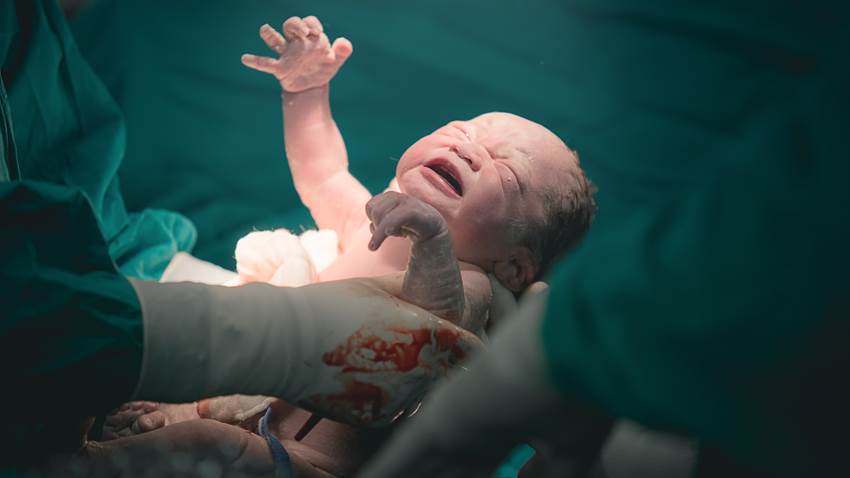 Continúa Puerto Rico con altas tasas de nacimientos por cesáreas, asegura experto