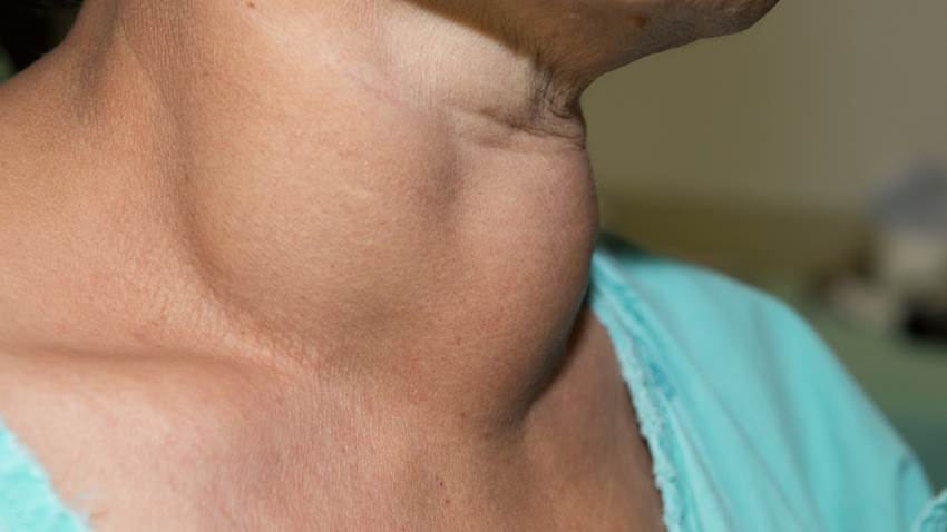 Médicos salvan vida de paciente con seis tumores primarios en Puerto Rico