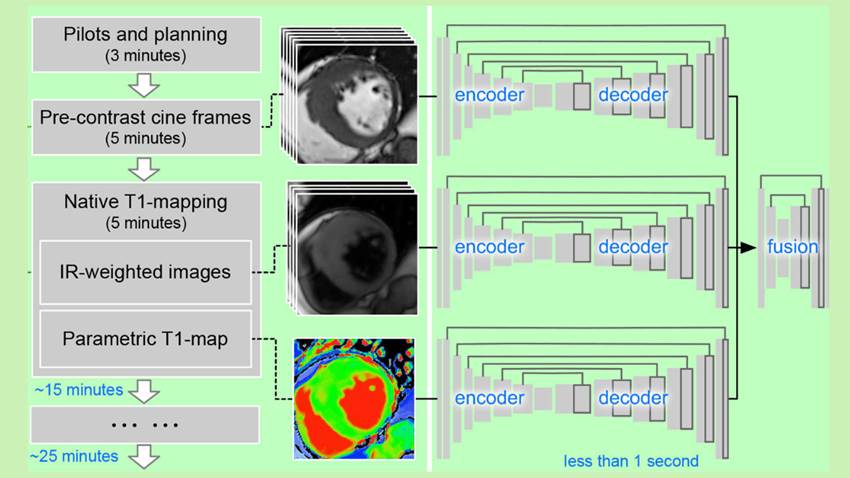 Inteligencia artificial podría mejorar exponencialmente los diagnósticos del corazón