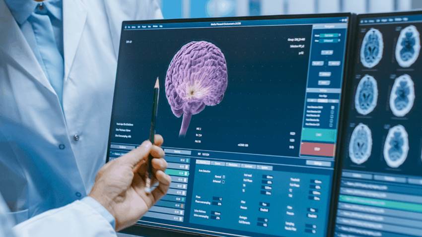 Dieta rica en flavonoides ayudaría a prevenir el deterioro cognitivo durante el envejecimiento