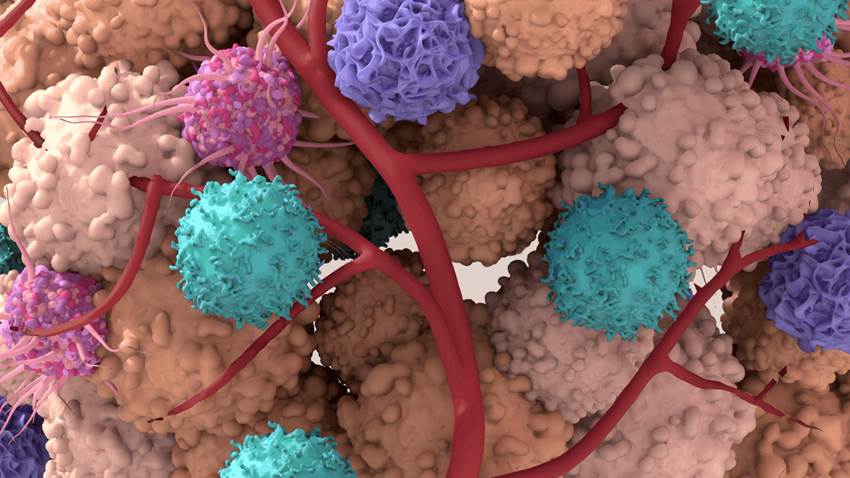 Tratamiento a base de  pembrolizumab en pacientes con melanoma plantea interrogantes