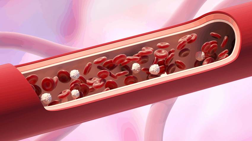 Mejorar la salud de los vasos sanguíneos en el cerebro ayudaría a combatir el alzhéimer