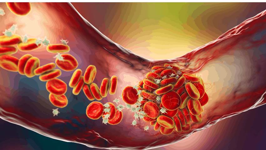 Desarrollan un fármaco proteico para la hipertensión arterial pulmonar