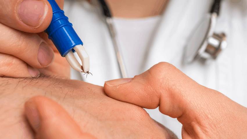 Enfermedad de Lyme: las últimas directrices sobre pruebas, profilaxis y tratamiento