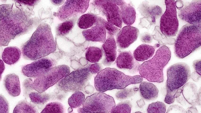 Las cuatro nuevas enfermedades de transmisión sexual que más preocupan a los expertos en la actualidad