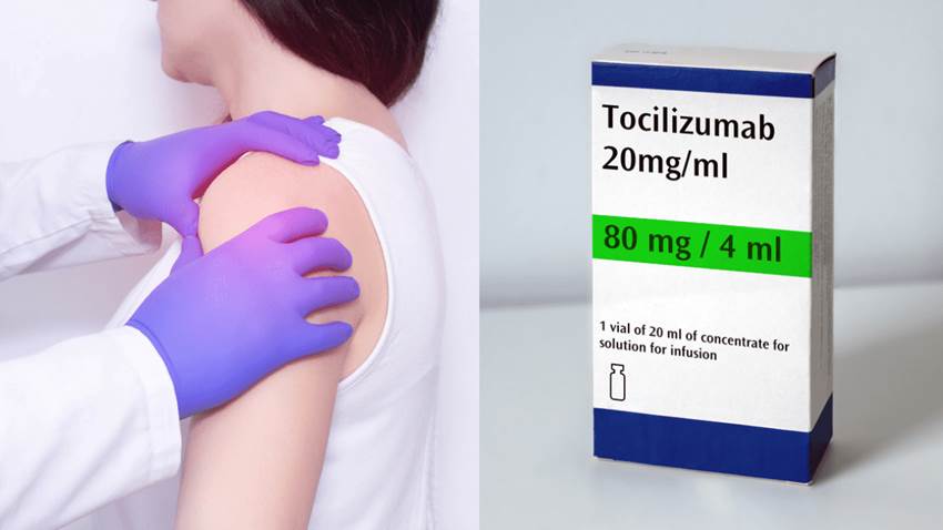 Estudio comprueba que tocilizumab mejora síntomas de la polimialgia reumática dependiente de esteroides