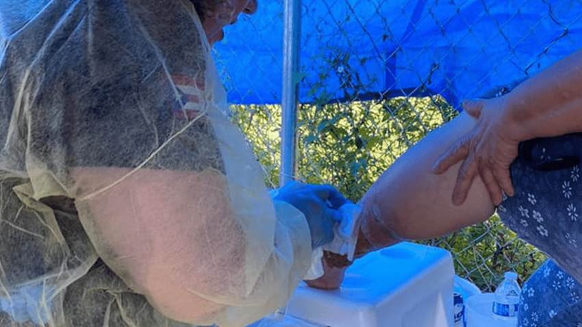 Heridas y emergencias ambientales: principales cuidados para evitar infecciones