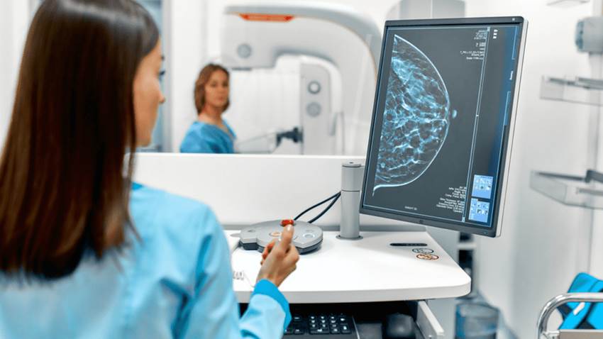 Posmenopausia y el riesgo de cáncer de mama en Puerto Rico