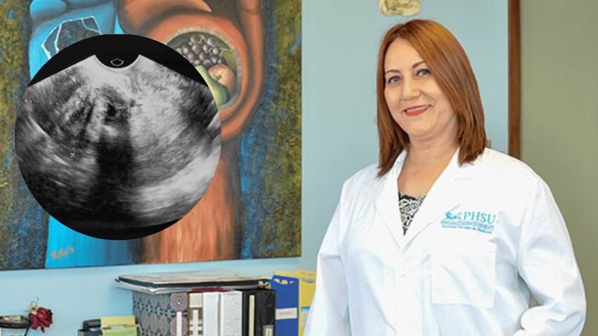 Estudio revela alta prevalencia de fibromas uterinos en mujeres puertorriqueñas