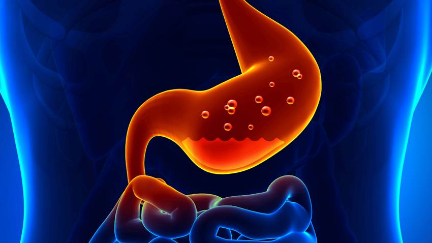 Qué es la gastritis y por qué la producción excesiva de ácido estomacal provoca úlceras gastroduodenales