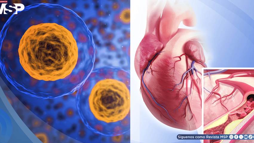 Descubren cómo revertir la acumulación de colesterol en las arterias restaurando la función de células vasculares