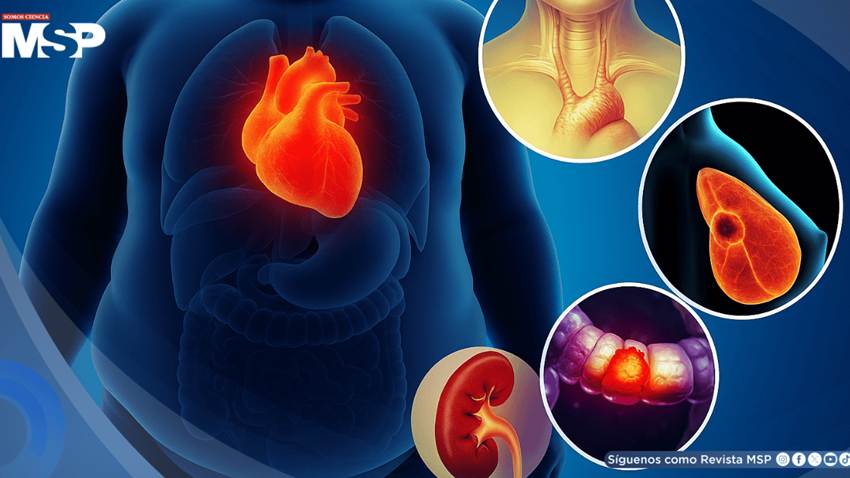 Alertan sobre el aumento de cánceres relacionados con la obesidad en jóvenes y adultos: Estudio