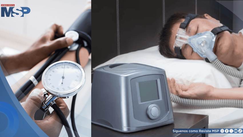 El uso del CPAP podría prevenir la hipertensión en pacientes con apnea del sueño, revela estudio