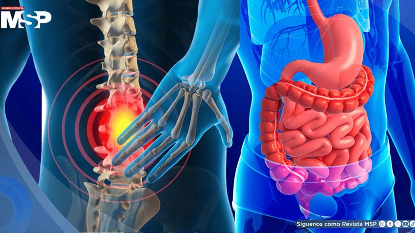 ¿Dolor de espalda constante? trastornos digestivos estarían relacionados con el dolor lumbar