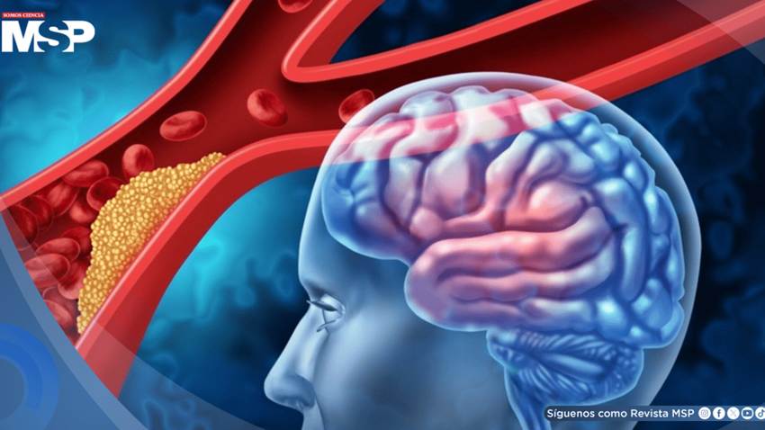 Ocho bebidas energéticas al día desencadenarían un derrame cerebral: 