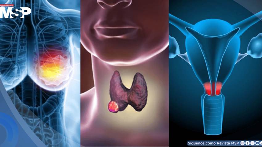 Las razones detrás del aumento del cáncer en mujeres menores de 50 años: Expertos