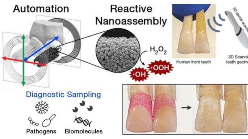 Desarrollan microrobots de limpieza bucal para ayudar a pacientes con dificultades motoras