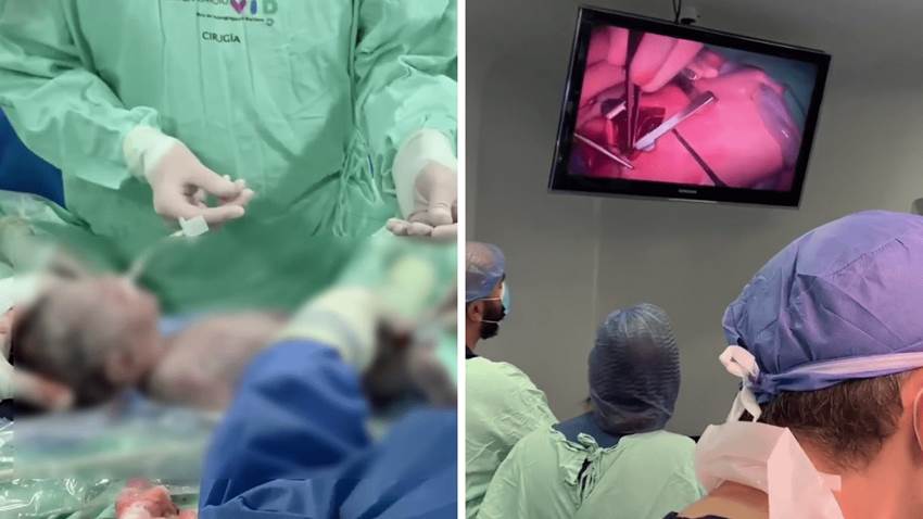 Latinoamérica: realizan primera cirugía cardiaca exitosa a bebé aún en la placenta de su madre
