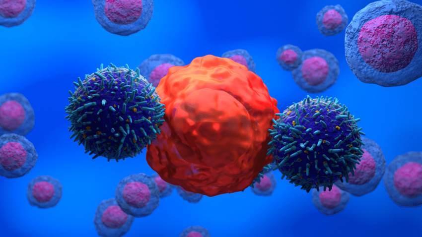 Tratamiento con células CAR-T experimental logra la remisión del lupus en cinco pacientes