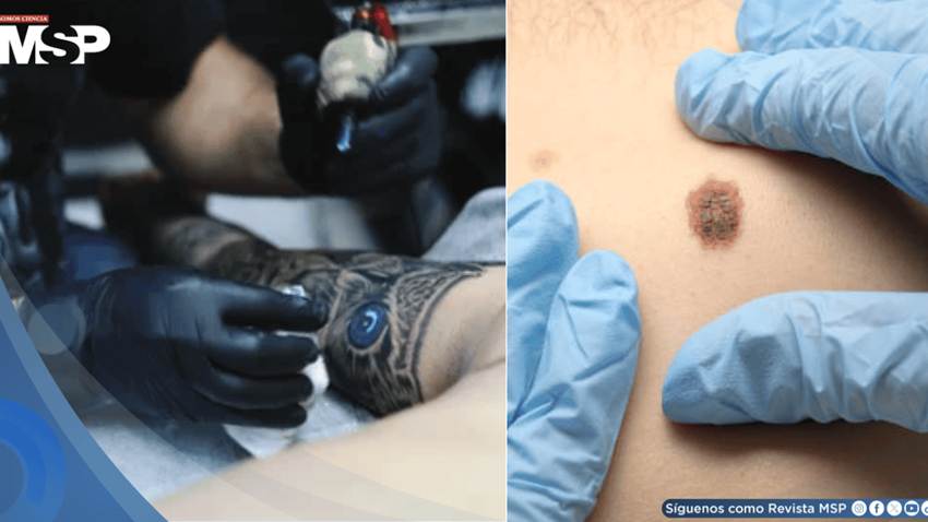 Tatuajes y piercings dificultarían detección temprana de lesiones malignas en la piel, advierten médicos