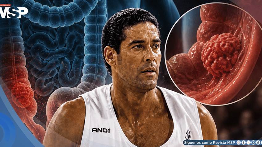 Cáncer colorrectal: estas son las señales de alerta de la enfermedad que enfrentó Piculín Ortiz