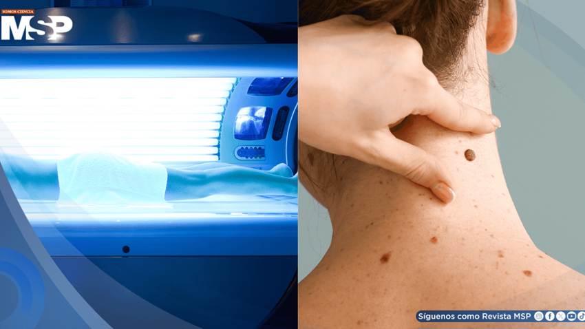 Expertos exigen prohibir las cabinas de bronceado por aumentar el riesgo de melanoma