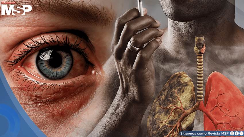 Fumar aumentaría el riesgo de ceguera: el daño sería irreversible incluso luego de dejar el cigarrillo