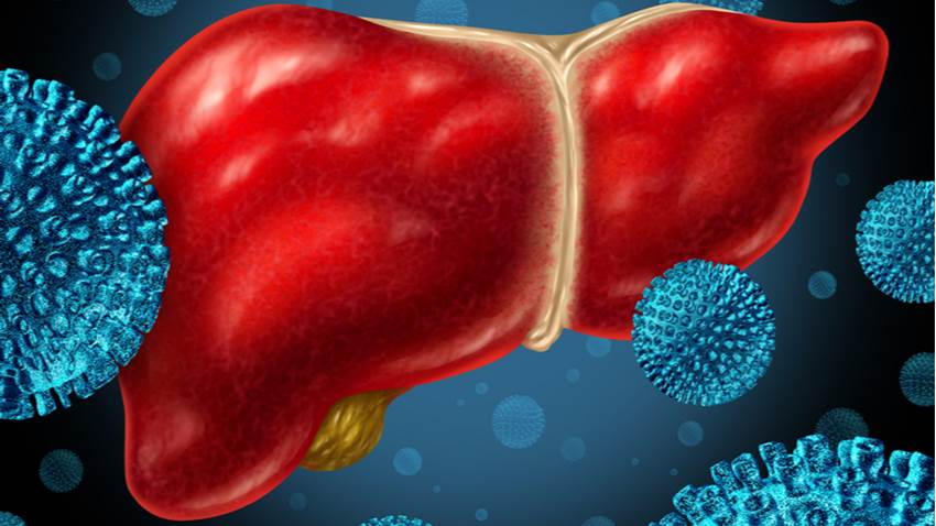 Hepatitis C un factor de riesgo para desarrollar cáncer de cabeza y cuello