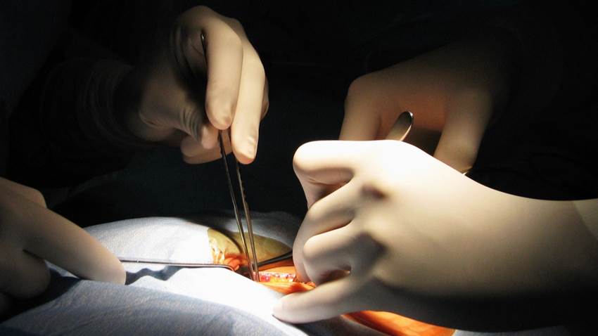 El riesgo de obesidad en pacientes que han recibido trasplante de hígado