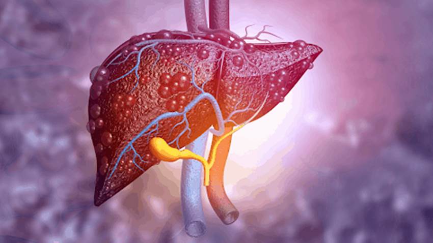 Identifican mecanismos moleculares para evitar el fallo hepático