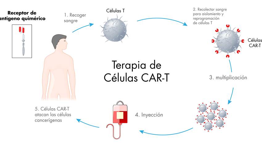 Primera terapia CAR-T para mieloma múltiple es aprobada por la FDA