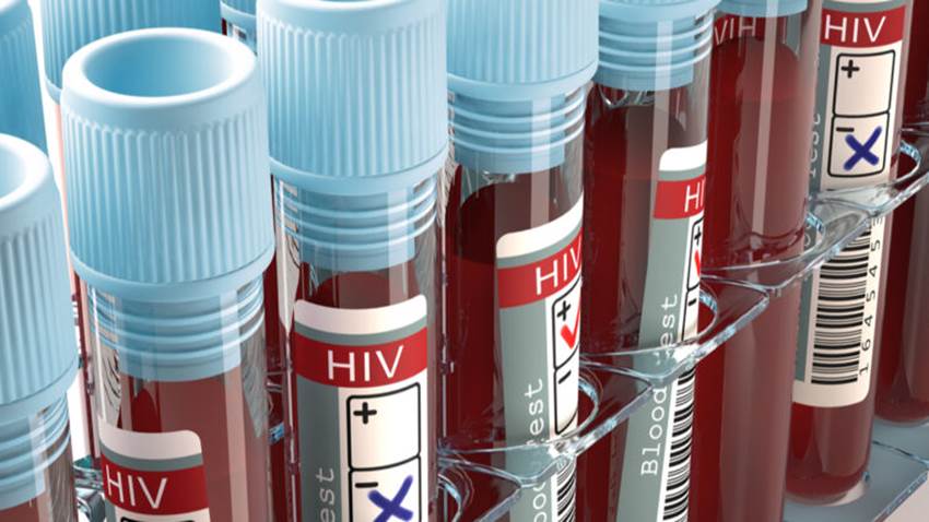 Los NIH invierten 14,6 millones de dólares en investigación que busca la cura del VIH