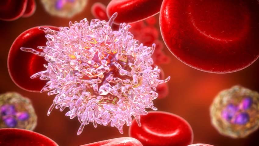 La FDA aprueba Onureg® como tratamiento continuo para adultos con leucemia mieloide aguda