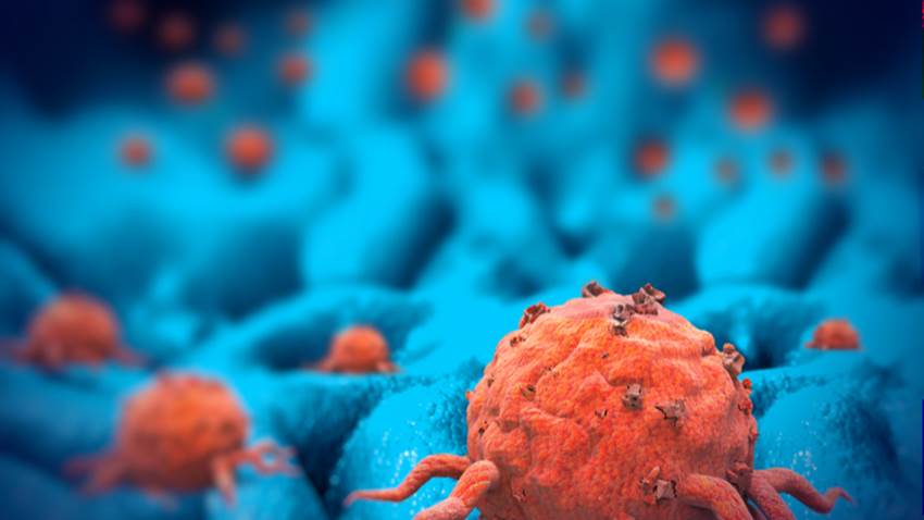 Cambios metabólicos podrían reducir el crecimiento de tumores malignos