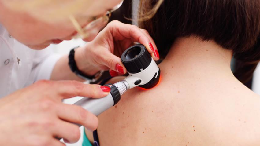 Nueva inmunoterapia podría retrasar la progresión del melanoma maligno