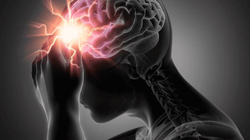 Omeprazol y esomeprazol podrían desencadenar migrañas, según estudio